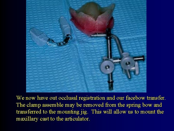 We now have out occlusal registration and our facebow transfer. The clamp assemble may