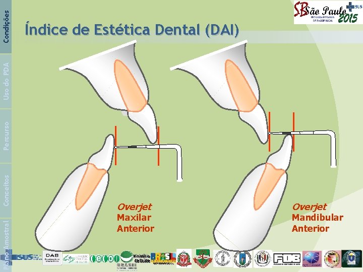 Condições Plano Amostral Conceitos Percurso Uso do PDA Índice de Estética Dental (DAI) Overjet