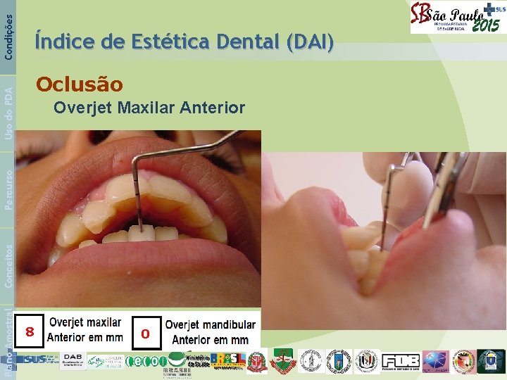 Condições Índice de Estética Dental (DAI) Uso do PDA Oclusão Plano Amostral Conceitos Percurso