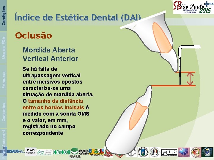 Condições Uso do PDA Percurso Conceitos Plano Amostral Índice de Estética Dental (DAI) Oclusão