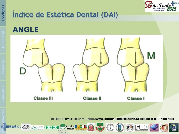 ANGLE Condições Plano Amostral Conceitos Percurso Uso do PDA Índice de Estética Dental (DAI)