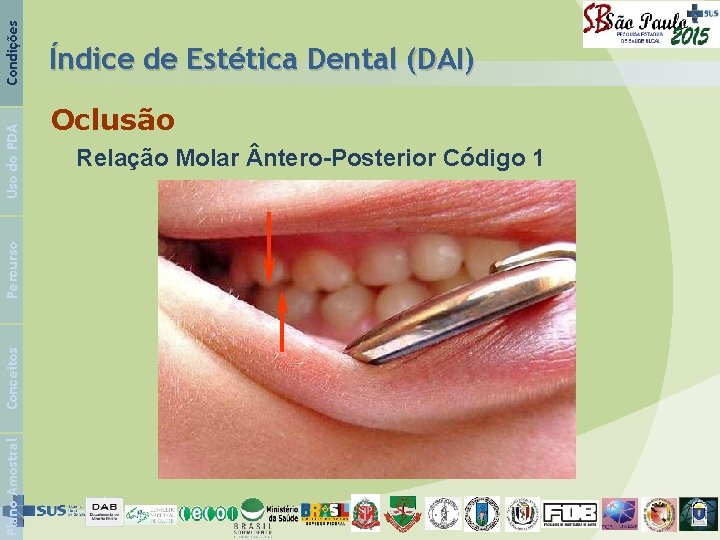 Condições Uso do PDA Percurso Conceitos Plano Amostral Índice de Estética Dental (DAI) Oclusão