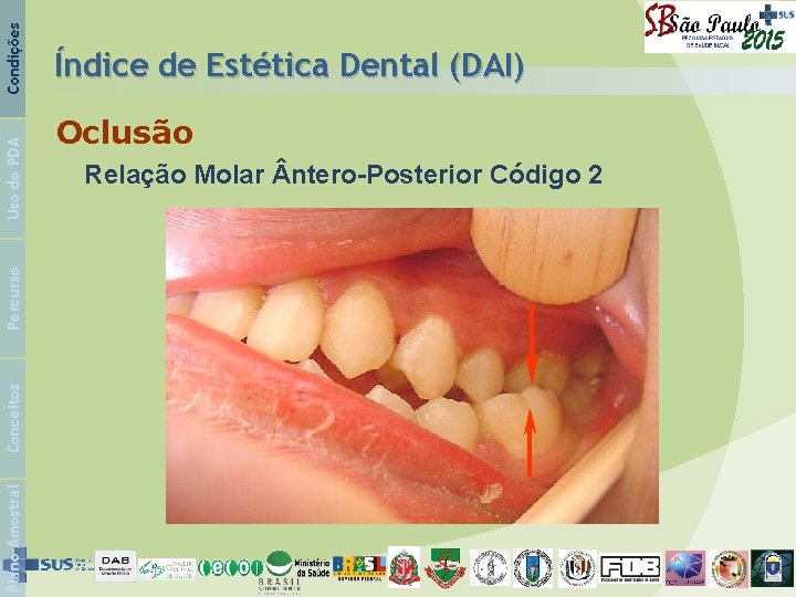 Condições Uso do PDA Percurso Conceitos Plano Amostral Índice de Estética Dental (DAI) Oclusão