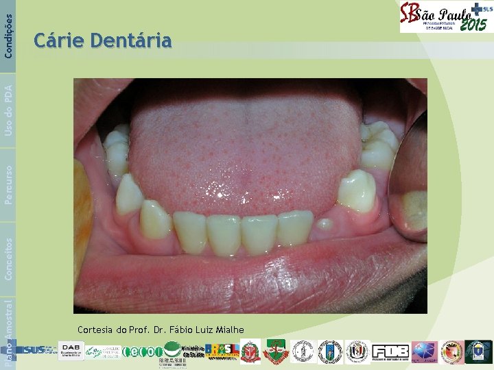 Condições Plano Amostral Conceitos Percurso Uso do PDA Cárie Dentária Cortesia do Prof. Dr.