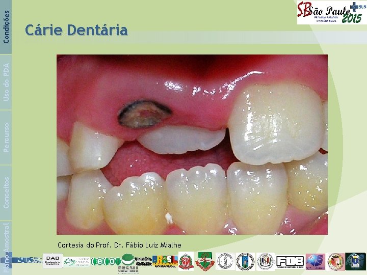 Condições Plano Amostral Conceitos Percurso Uso do PDA Cárie Dentária Cortesia do Prof. Dr.