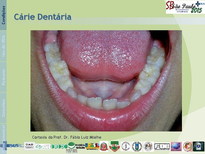 Condições Plano Amostral Conceitos Percurso Uso do PDA Cárie Dentária Cortesia do Prof. Dr.