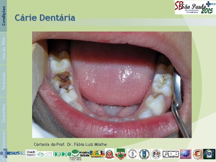 Condições Plano Amostral Conceitos Percurso Uso do PDA Cárie Dentária Cortesia do Prof. Dr.