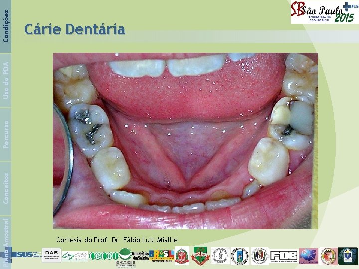 Condições Plano Amostral Conceitos Percurso Uso do PDA Cárie Dentária Cortesia do Prof. Dr.