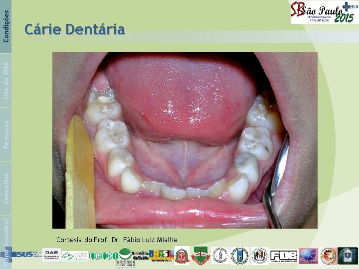 Condições Plano Amostral Conceitos Percurso Uso do PDA Cárie Dentária Cortesia do Prof. Dr.