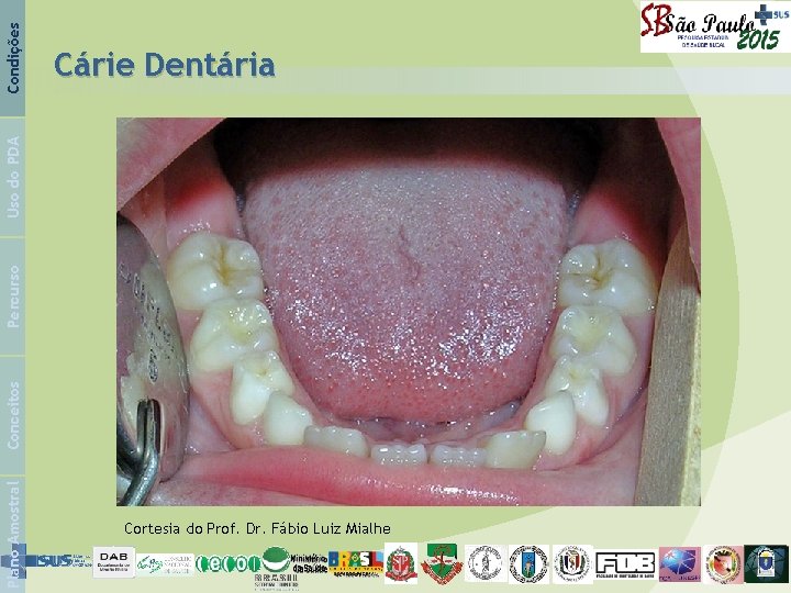 Condições Plano Amostral Conceitos Percurso Uso do PDA Cárie Dentária Cortesia do Prof. Dr.
