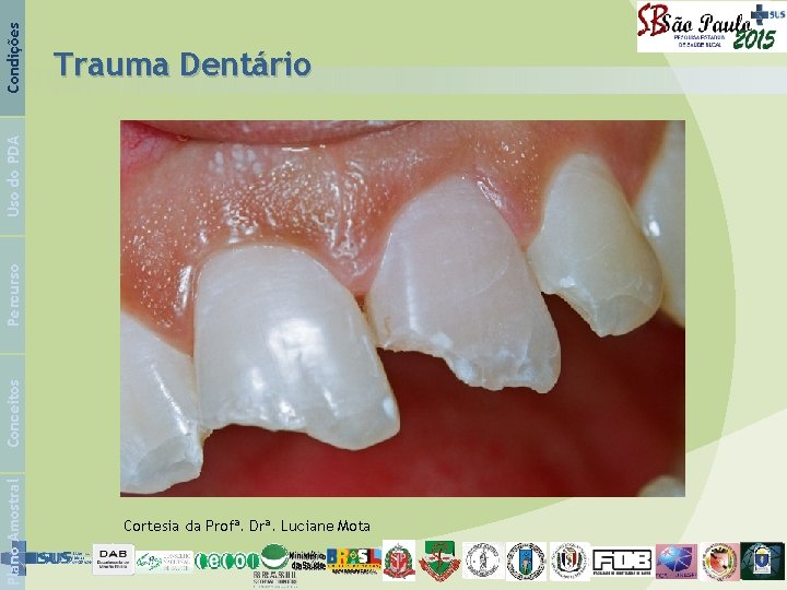 Condições Plano Amostral Conceitos Percurso Uso do PDA Trauma Dentário Cortesia da Profª. Drª.