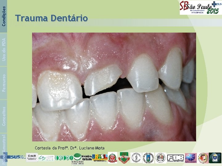 Condições Plano Amostral Conceitos Percurso Uso do PDA Trauma Dentário Cortesia da Profª. Drª.