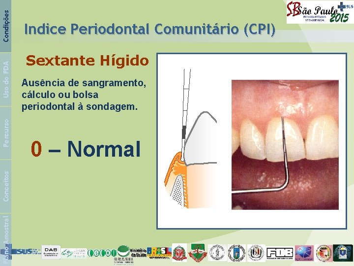 Condições Uso do PDA Percurso Conceitos Plano Amostral Indice Periodontal Comunitário (CPI) Sextante Hígido