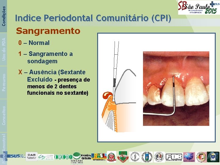Condições Uso do PDA Percurso Conceitos Plano Amostral Indice Periodontal Comunitário (CPI) Sangramento 0