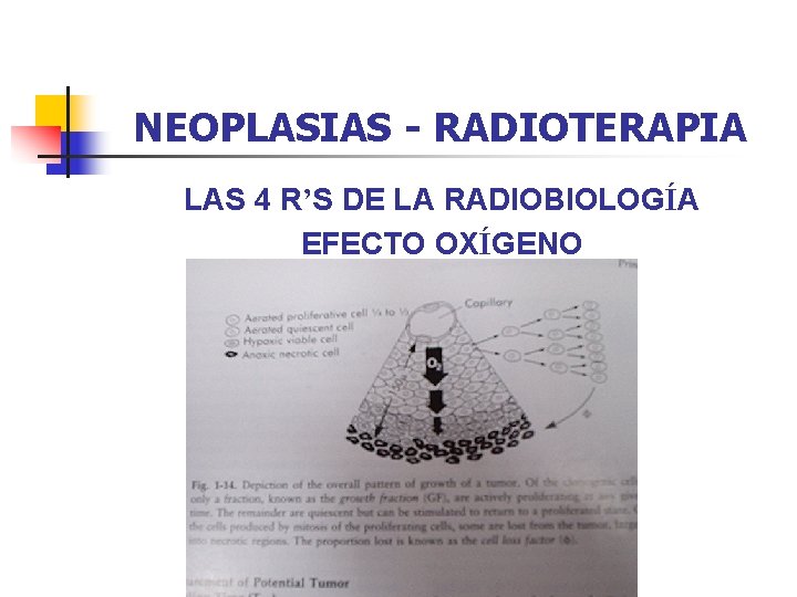 NEOPLASIAS - RADIOTERAPIA LAS 4 R’S DE LA RADIOBIOLOGÍA EFECTO OXÍGENO 