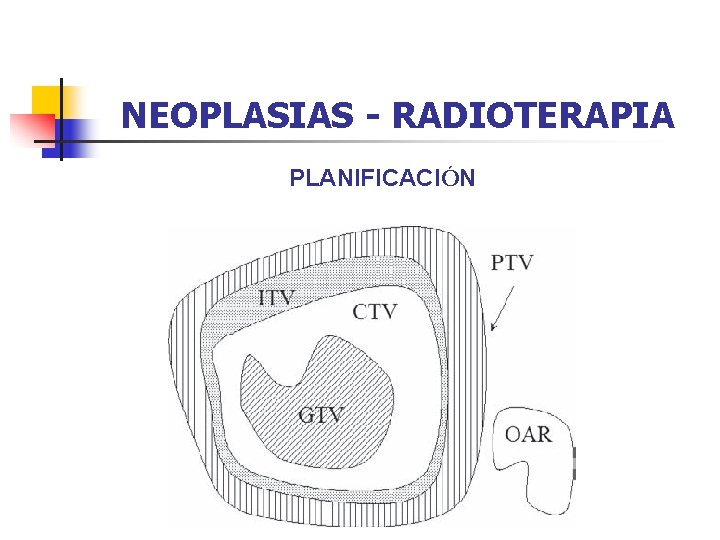 NEOPLASIAS - RADIOTERAPIA PLANIFICACIÓN 