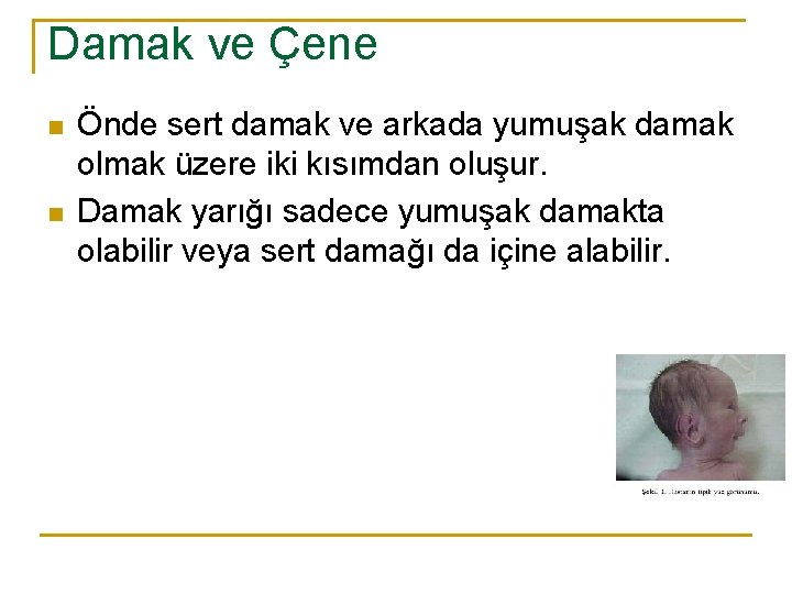 Damak ve Çene n n Önde sert damak ve arkada yumuşak damak olmak üzere