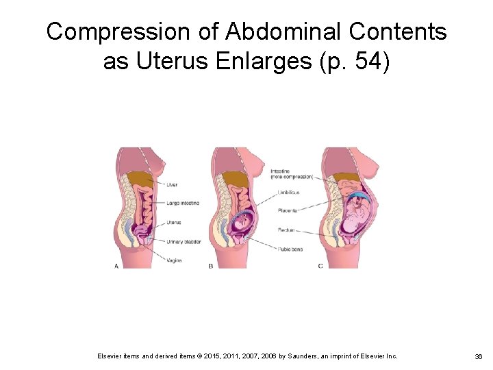 Compression of Abdominal Contents as Uterus Enlarges (p. 54) Elsevier items and derived items