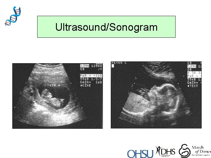 Ultrasound/Sonogram 