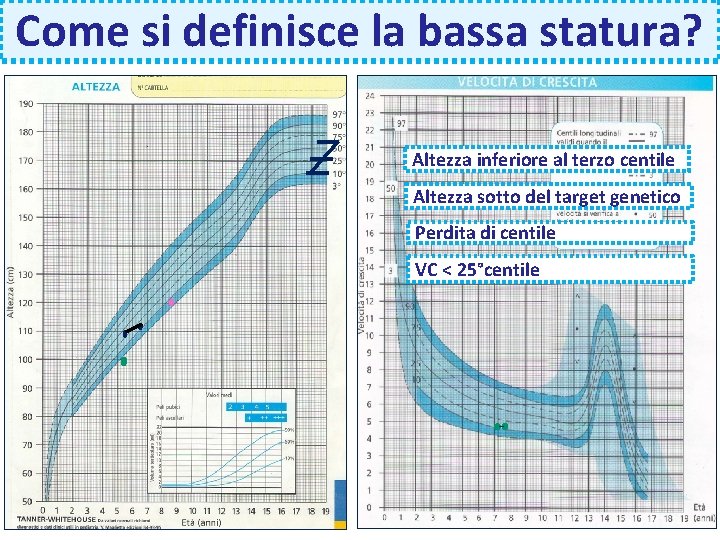 Come si definisce la bassa statura? Altezza inferiore al terzo centile Altezza sotto del