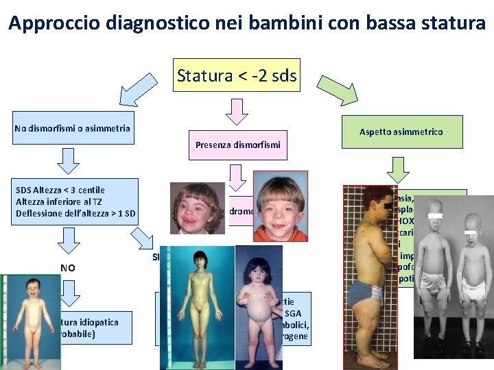 Approccio diagnostico nei bambini con bassa statura Statura < -2 sds No dismorfismi o