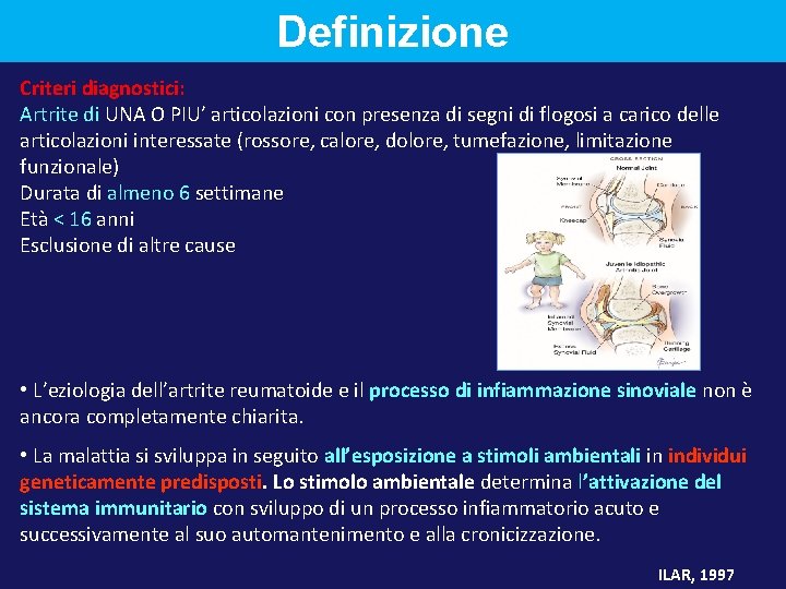 Definizione Criteri diagnostici: Artrite di UNA O PIU’ articolazioni con presenza di segni di