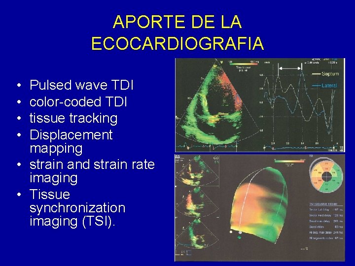 APORTE DE LA ECOCARDIOGRAFIA • • Pulsed wave TDI color-coded TDI tissue tracking Displacement