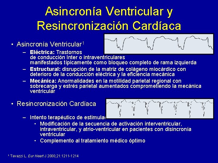 Asincronía Ventricular y Resincronización Cardíaca • Asincronía Ventricular 1 – Eléctrica: Trastornos de conducción