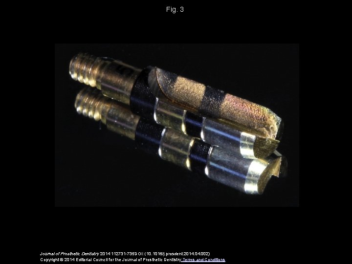 Fig. 3 Journal of Prosthetic Dentistry 2014 112731 -735 DOI: (10. 1016/j. prosdent. 2014.