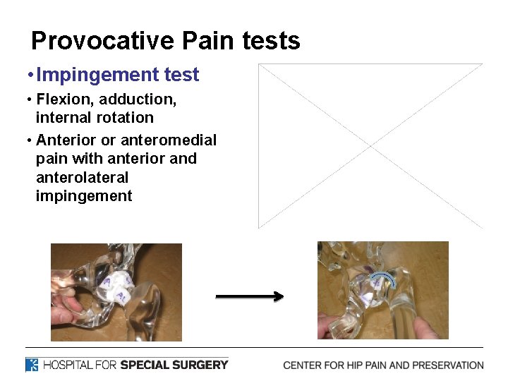 Provocative Pain tests • Impingement test • Flexion, adduction, internal rotation • Anterior or