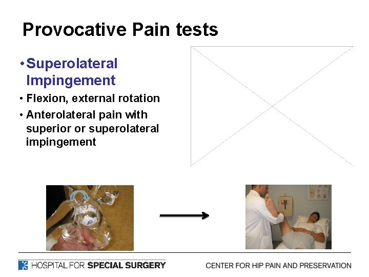 Provocative Pain tests • Superolateral Impingement • Flexion, external rotation • Anterolateral pain with