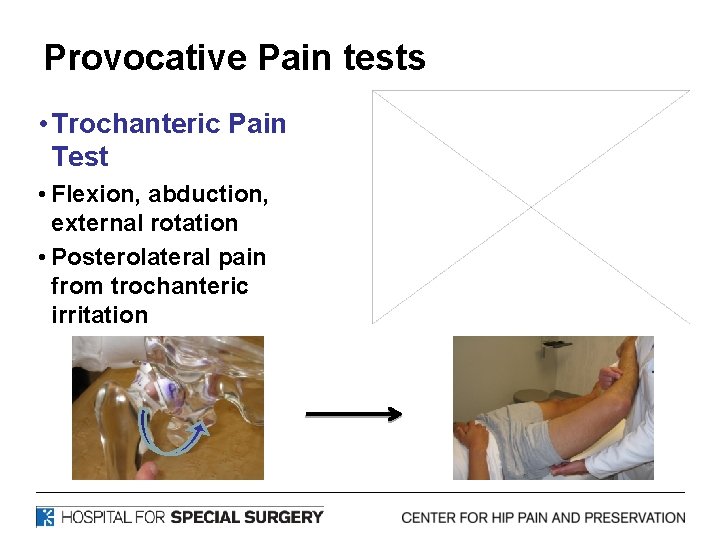 Provocative Pain tests • Trochanteric Pain Test • Flexion, abduction, external rotation • Posterolateral