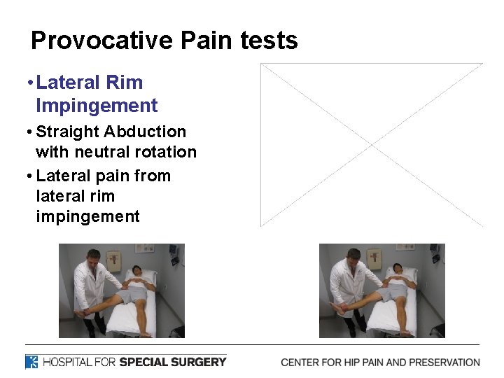 Provocative Pain tests • Lateral Rim Impingement • Straight Abduction with neutral rotation •