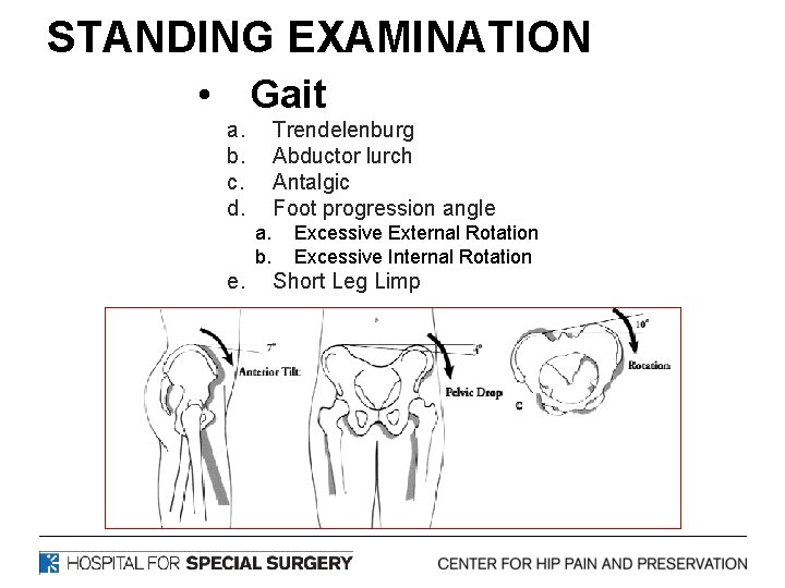 STANDING EXAMINATION • Gait a. b. c. d. Trendelenburg Abductor lurch Antalgic Foot progression