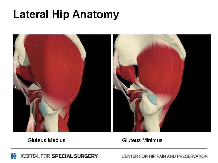 Lateral Hip Anatomy Gluteus Medius Gluteus Minimus 