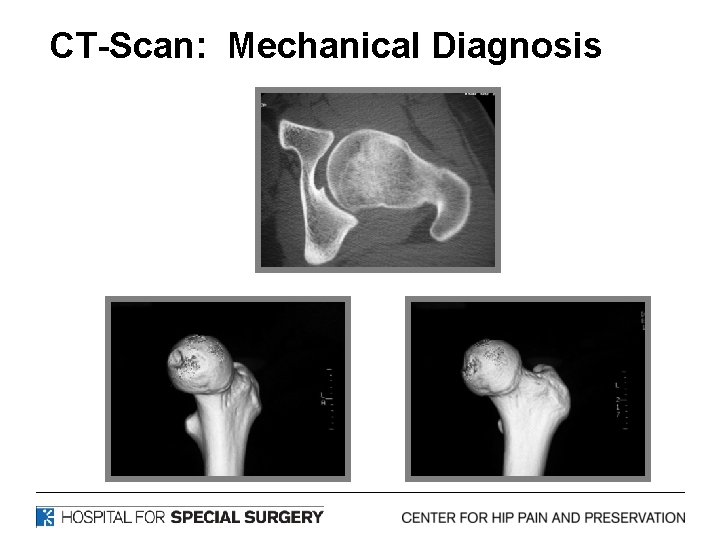 CT-Scan: Mechanical Diagnosis 