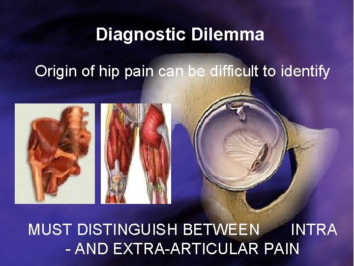 Diagnostic Dilemma Origin of hip pain can be difficult to identify MUST DISTINGUISH BETWEEN