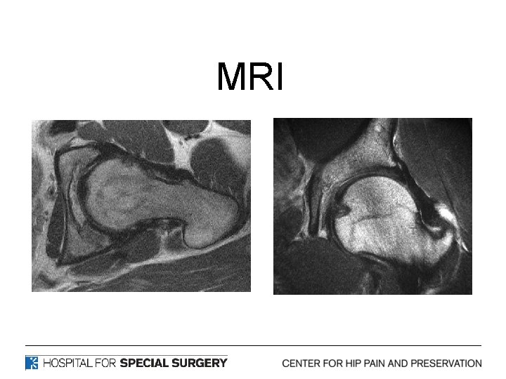 MRI 