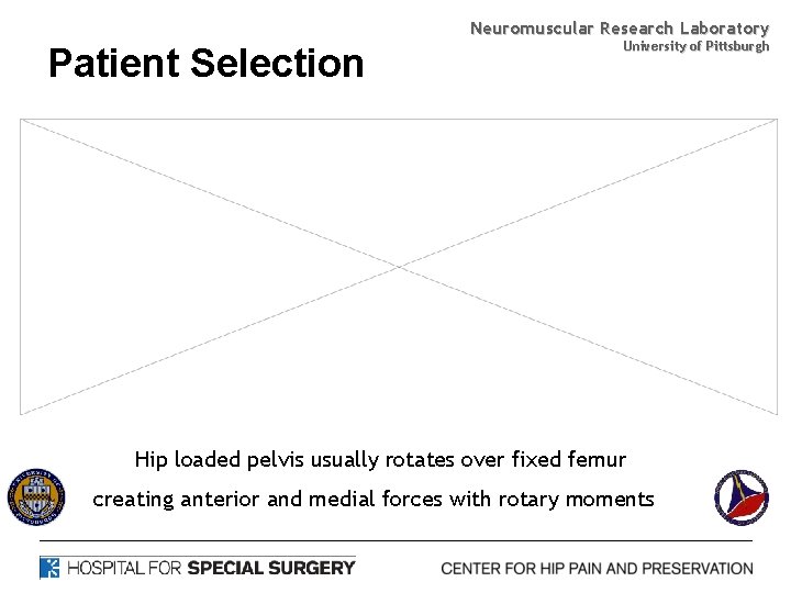 Neuromuscular Research Laboratory Patient Selection University of Pittsburgh Hip loaded pelvis usually rotates over