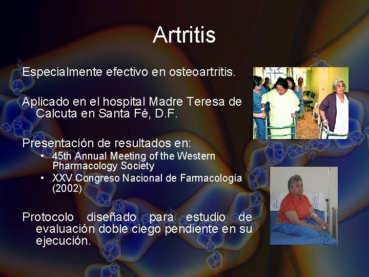Artritis Especialmente efectivo en osteoartritis. Aplicado en el hospital Madre Teresa de Calcuta en Artritis Especialmente efectivo en osteoartritis. Aplicado en el hospital Madre Teresa de Calcuta en