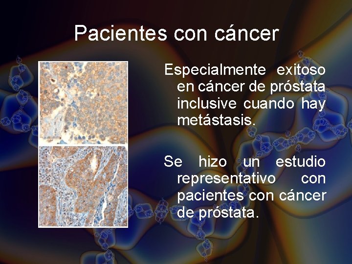 Pacientes con cáncer Especialmente exitoso en cáncer de próstata inclusive cuando hay metástasis. Se Pacientes con cáncer Especialmente exitoso en cáncer de próstata inclusive cuando hay metástasis. Se