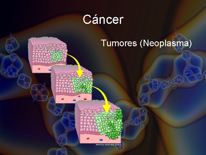 Cáncer Tumores (Neoplasma) Cáncer Tumores (Neoplasma)