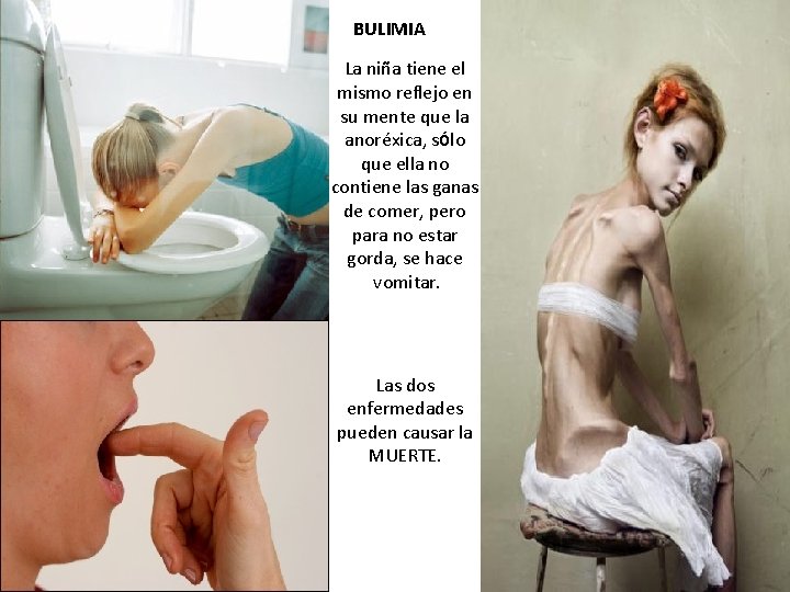 BULIMIA La niña tiene el mismo reflejo en su mente que la anoréxica, sólo