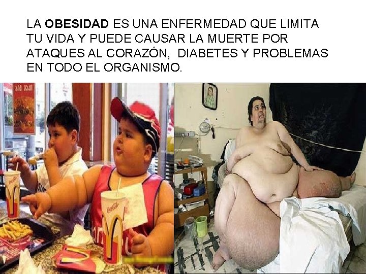 LA OBESIDAD ES UNA ENFERMEDAD QUE LIMITA TU VIDA Y PUEDE CAUSAR LA MUERTE