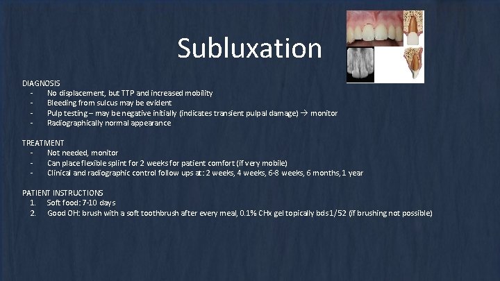 Subluxation DIAGNOSIS No displacement, but TTP and increased mobility Bleeding from sulcus may be Subluxation DIAGNOSIS No displacement, but TTP and increased mobility Bleeding from sulcus may be