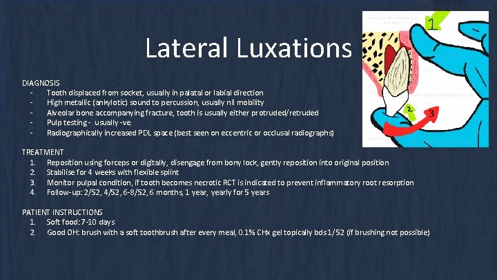 Lateral Luxations DIAGNOSIS Tooth displaced from socket, usually in palatal or labial direction High Lateral Luxations DIAGNOSIS Tooth displaced from socket, usually in palatal or labial direction High