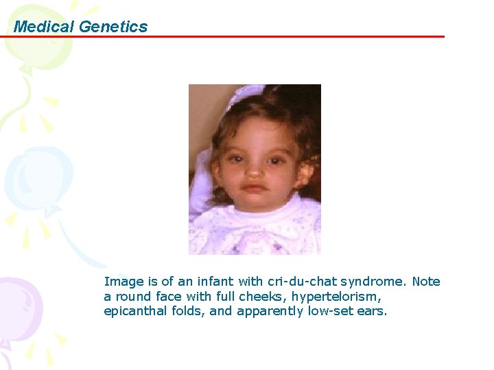 Medical Genetics Image is of an infant with cri-du-chat syndrome. Note a round face