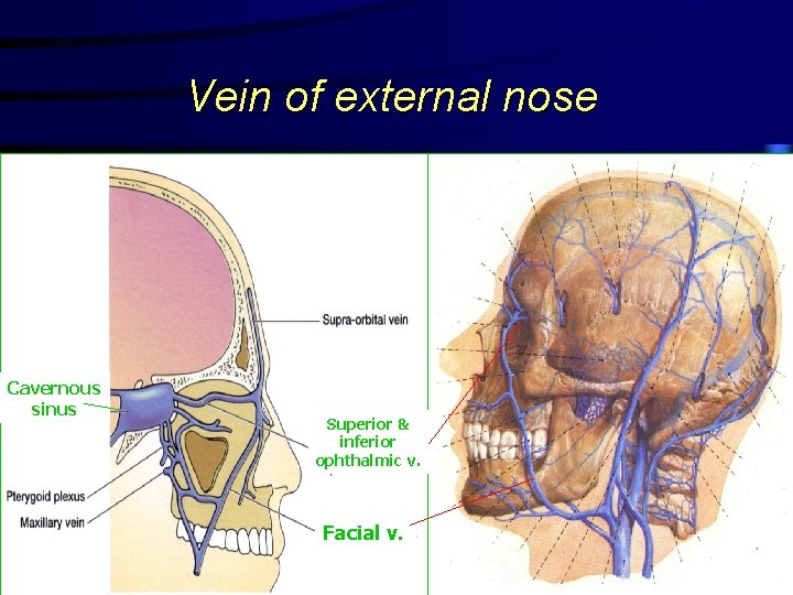 Vein of external nose Cavernous sinus Superior & inferior ophthalmic v. Facial v. 