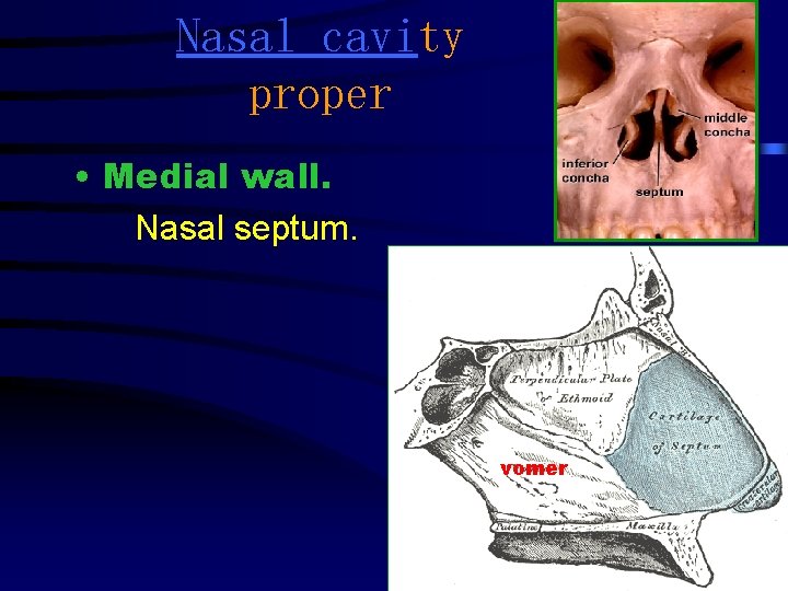 Nasal cavity proper • Medial wall. Nasal septum. vomer 