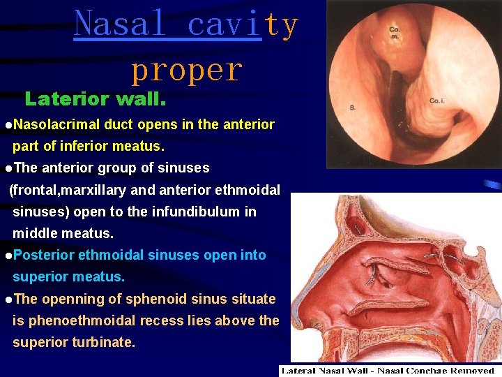 Nasal cavity proper Laterior wall. l. Nasolacrimal duct opens in the anterior part of